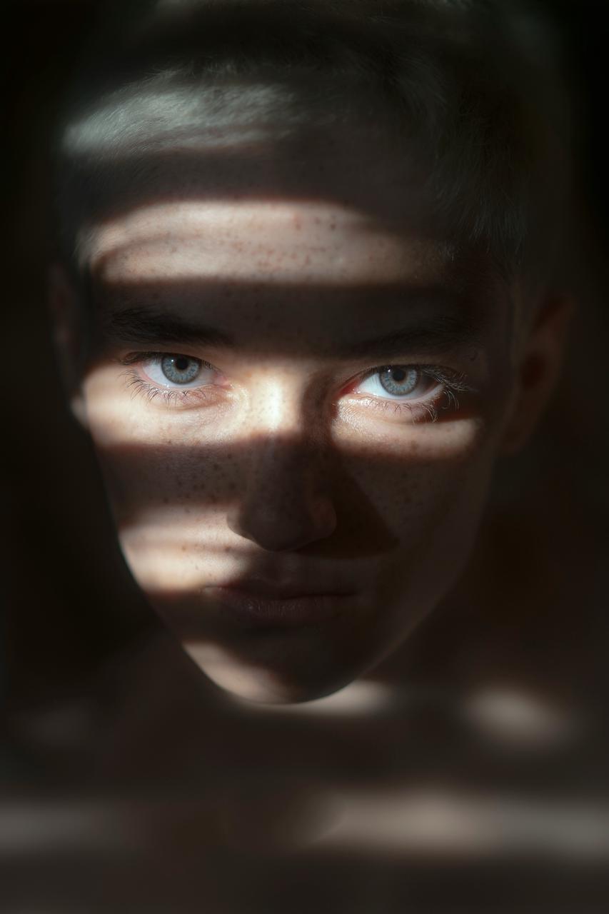 Dark Spots on Face : Causes, Treatments, and How to Get Rid of Them